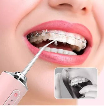 AquaSmile Pro – Irrigador Dental Profesional Portátil